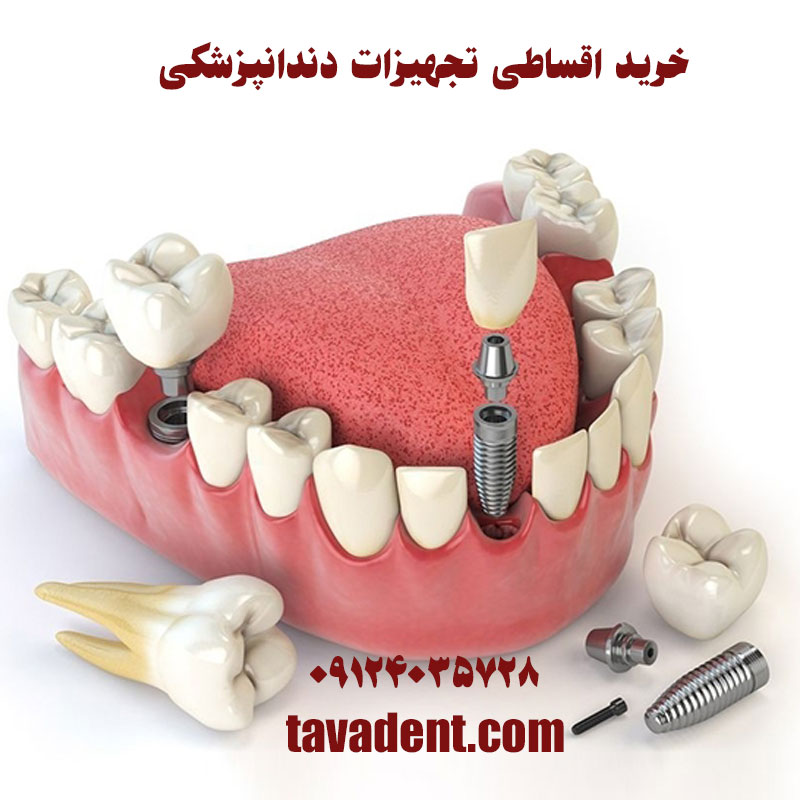 خرید اقساطی تجهیزات دندانپزشکی